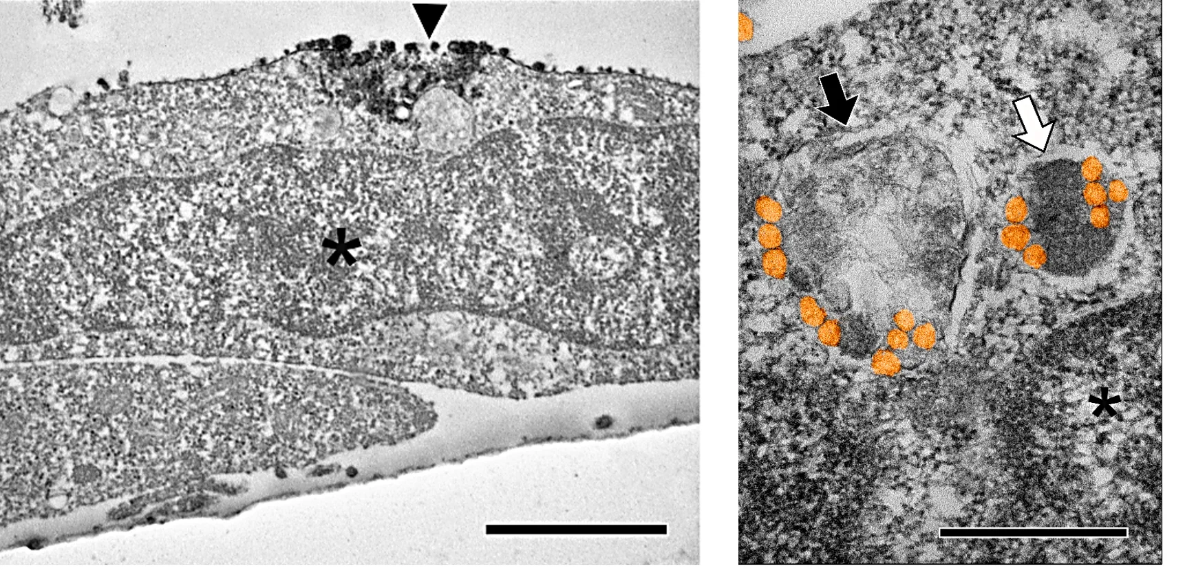 nanoplastiche plastica 