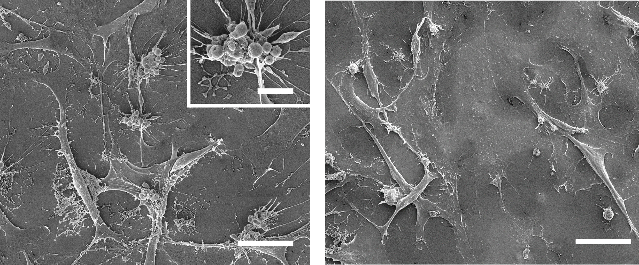 nanoplastiche plastica